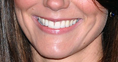 Celebrities That Have Had Cosmetic Dental Treatment